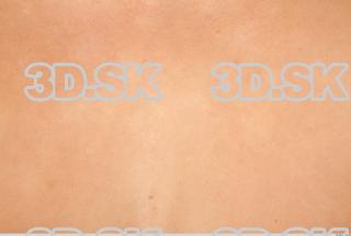 Skin texture of Saskie 0001